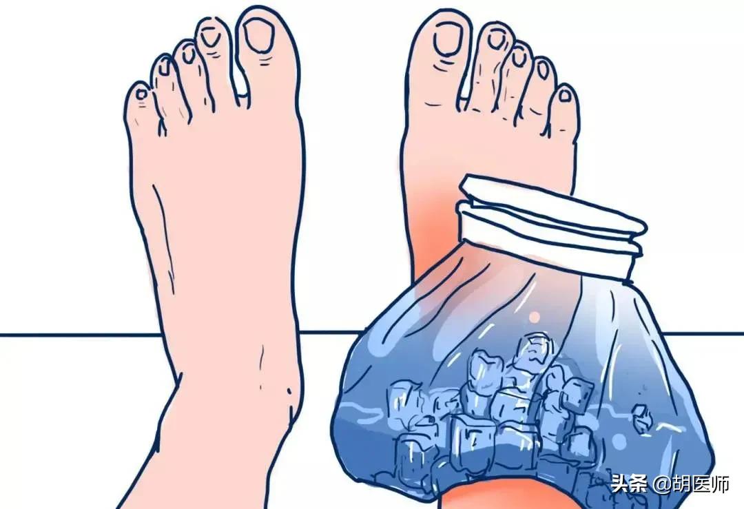 关于踝关节扭伤的正确处理方法,踝关节扭伤的早期处理原则是什么