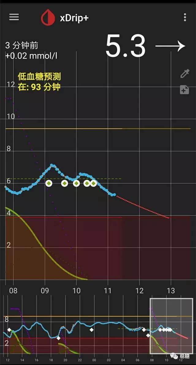胰岛素泵闭环控糖效果,闭环胰岛素泵是什么意思