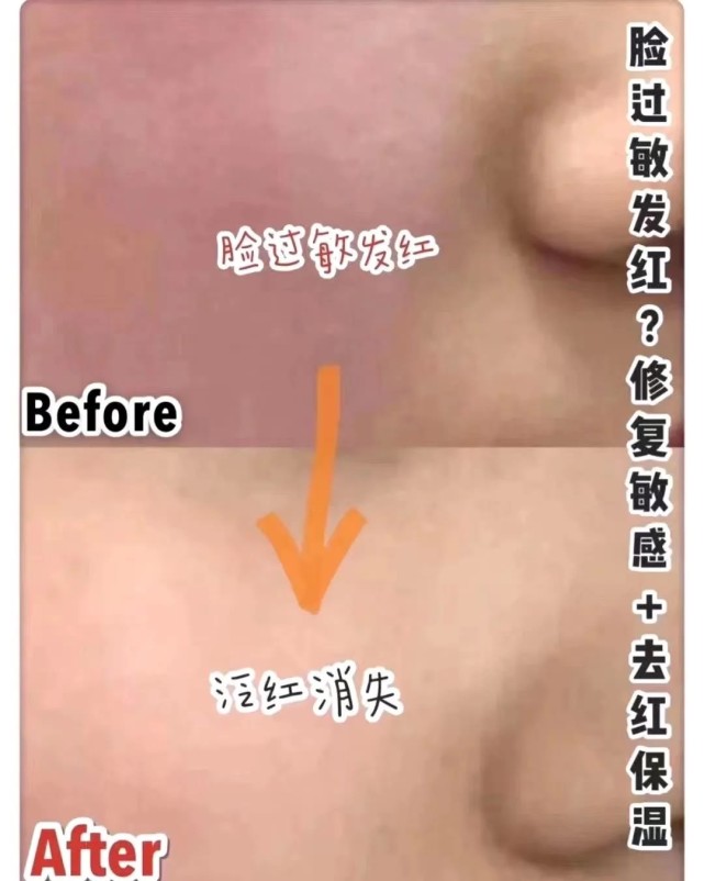 推荐几款好用的韩国面膜,补水超好的韩国面膜推荐