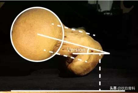 髋膝关节文献精译荟萃