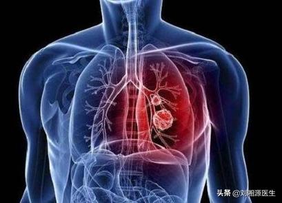 「免疫相关不良妊娠答疑解惑40」——系统性血管炎