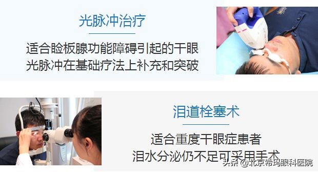 眼干来滴眼药水？年轻人，这些治疗方式比滴眼药水好使多了