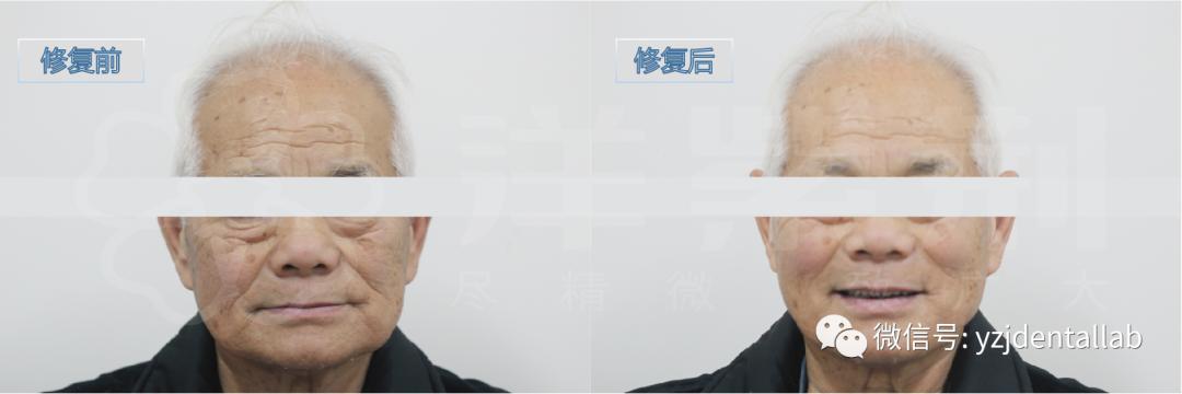 病例教学视频,病例分析操作技能