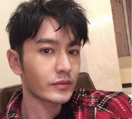 上了年纪发际线,黄晓明额头