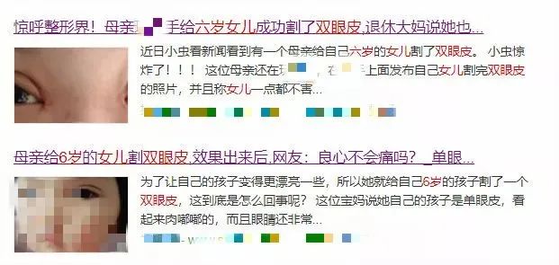 八个月宝宝单眼皮逆袭双眼皮,单眼皮宝宝早日逆袭成功变双眼皮