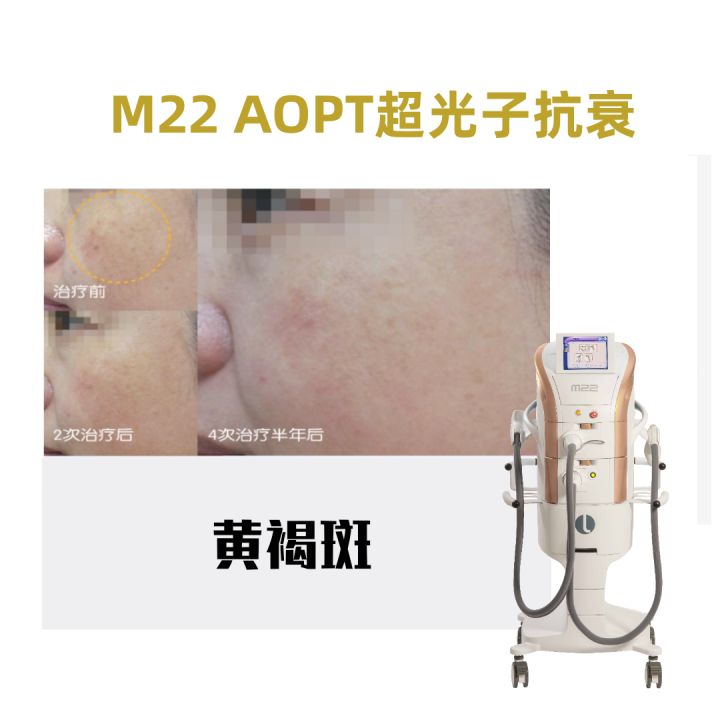 哪种医美项目祛痘印最有效,最有效的医美抗衰项目