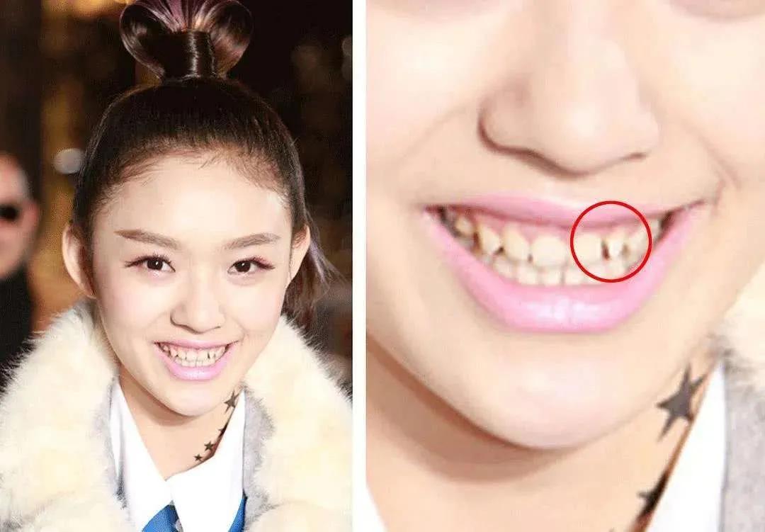 《极挑》热巴脸垮严重，网友：做了烤瓷牙的热巴“花期太短了”