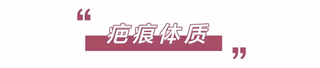 想打耳洞又怕打了不好看,想打耳洞但是怕耳洞长脏东西