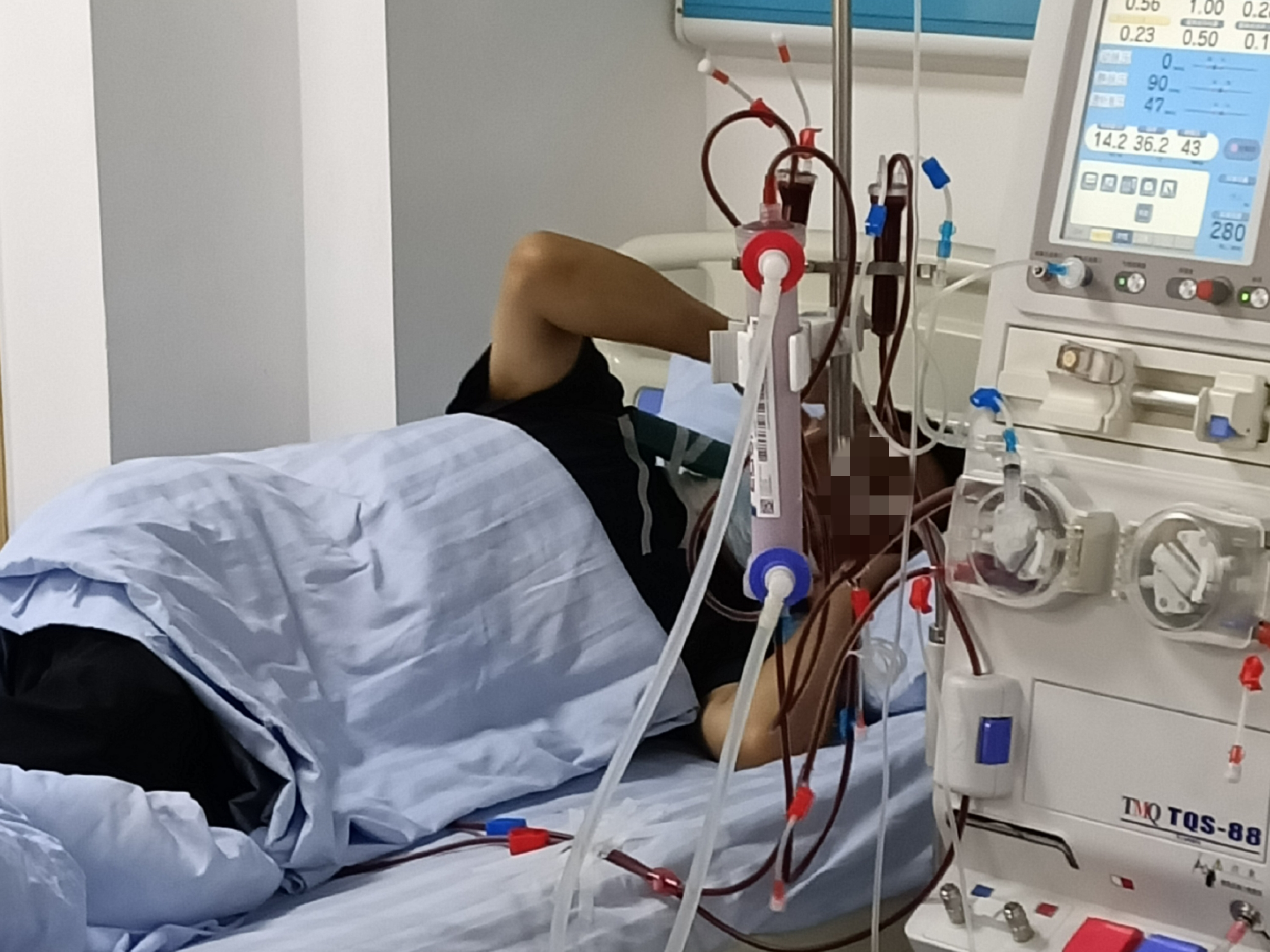 肝检查有哪些项目一套多少钱,做什么项目是检查肾