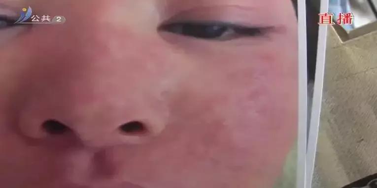 威海医院美容科祛斑,威海环翠区美容祛斑