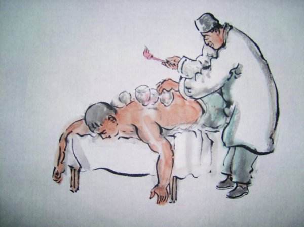 比较好的中医治疗颈椎病的书,中医治疗颈椎病的中药方