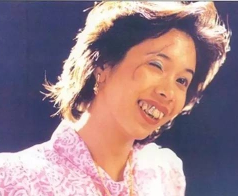 盘点影视剧中五大龅牙,阴阳脸朱顶红