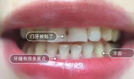 杨颖和姚晨演技,姚晨和杨颖谁的嘴巴大