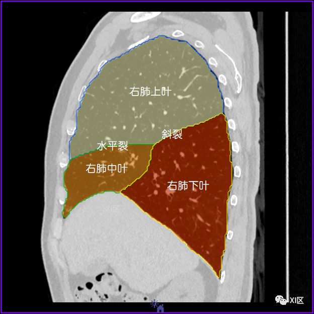 如此详细的肺部影像解剖，有点儿酷