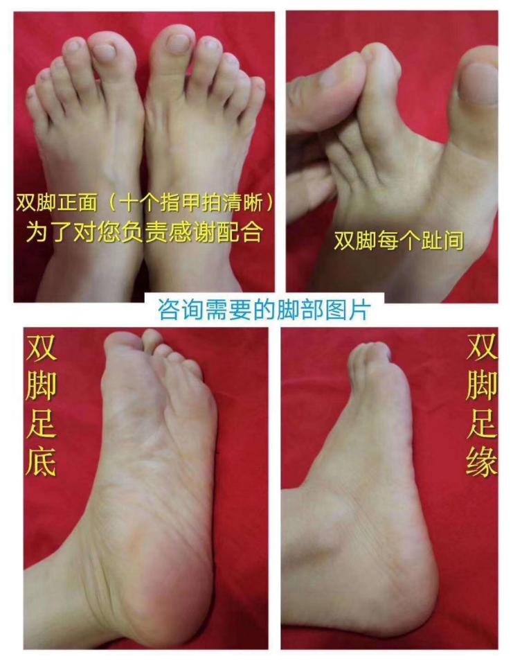 家里治脚气最好的方法,家庭治脚气的最好方法