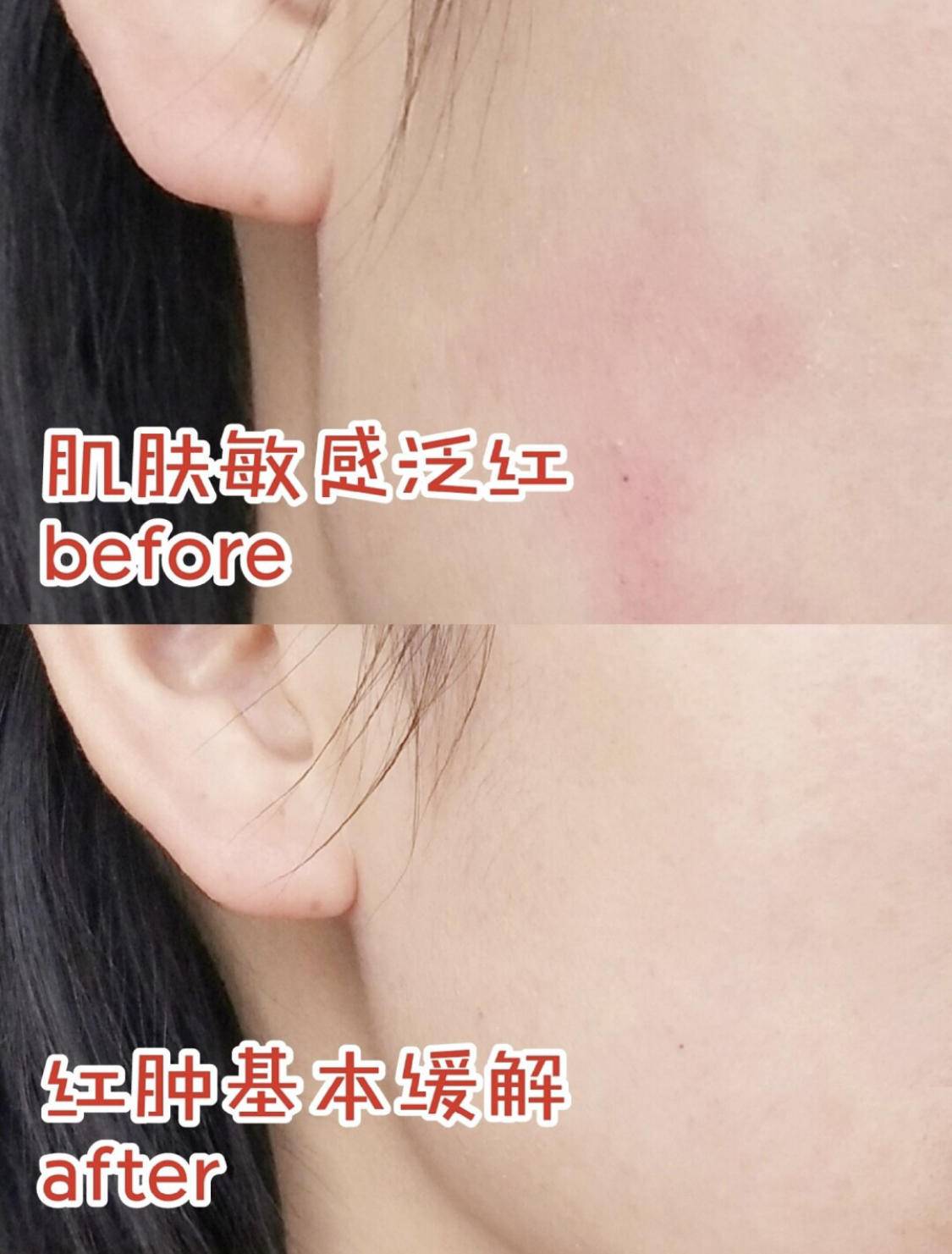 敏感肌肤抗衰产品推荐女,好物推荐敏感肌精华