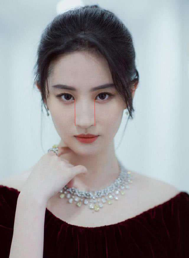 鼻头大鼻翼宽怎么改鼻痕,整鼻不好看怎么办