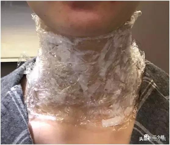 医美去颈纹全过程,去颈纹医美过程