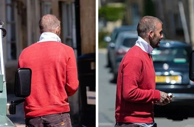 贝克汉姆什么原因脱发,贝克汉姆严重脱发