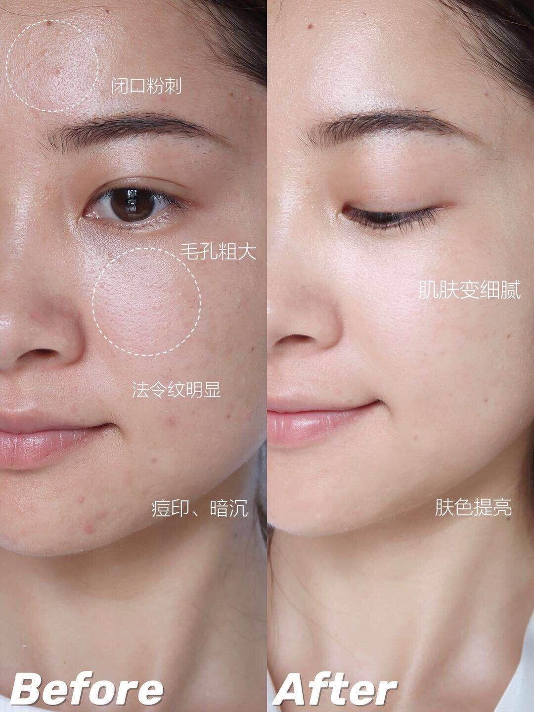 超市常见的护肤品推荐,良心的国货护肤品有哪些