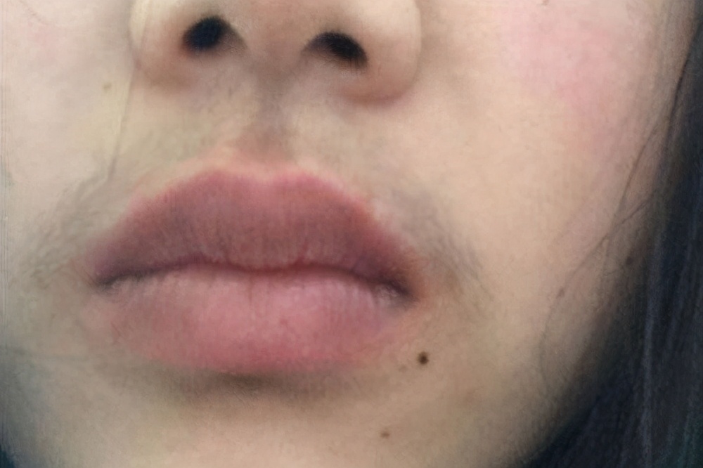 女生长胡子什么原因怎么解决,女生长胡子是什么原因怎么消掉