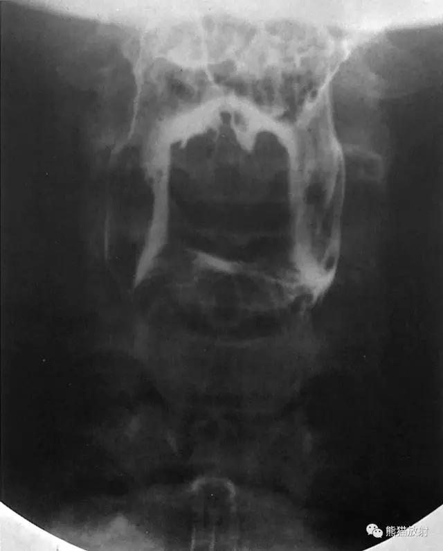 详细的消化道造影+彩色解剖图