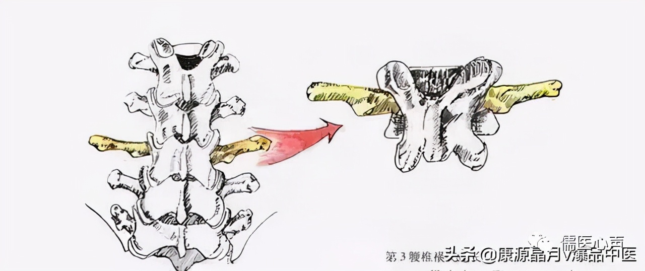 不能弯腰一侧腰腿不舒服,不能弯腰一弯腰就疼