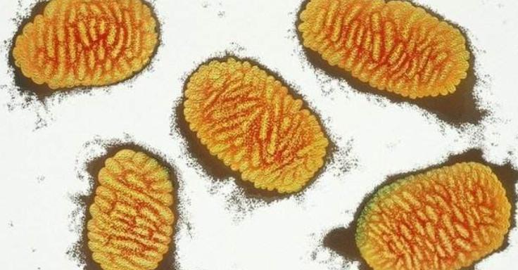 天花病毒如何干掉人类,天花病毒怎么意外消灭的