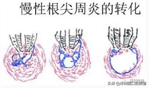 牙疼的滋味没人能理解,牙疼的痛苦有谁能够体会