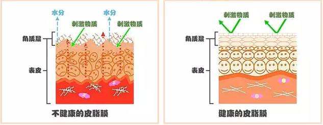 晒后起皮如何有效补水,晒伤干皮后如何修复