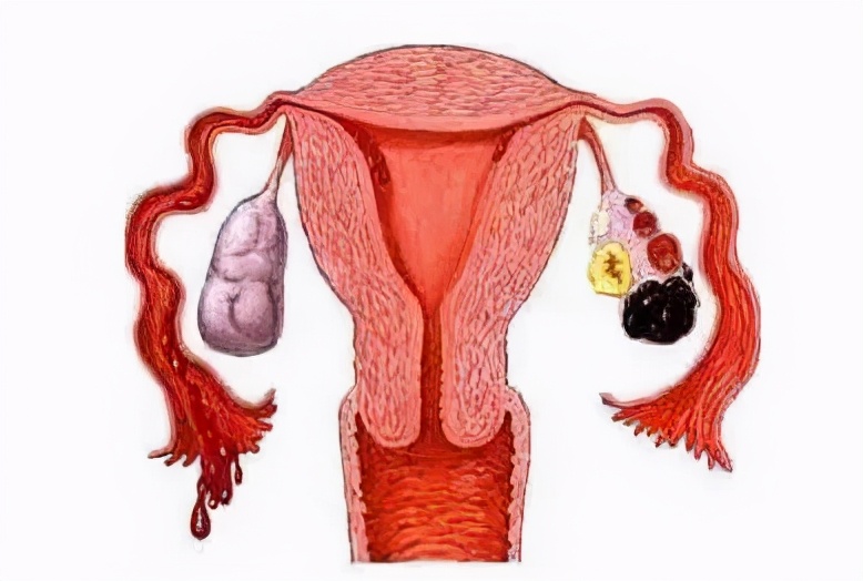 巧囊自然怀孕成功率,巧囊自己消失了