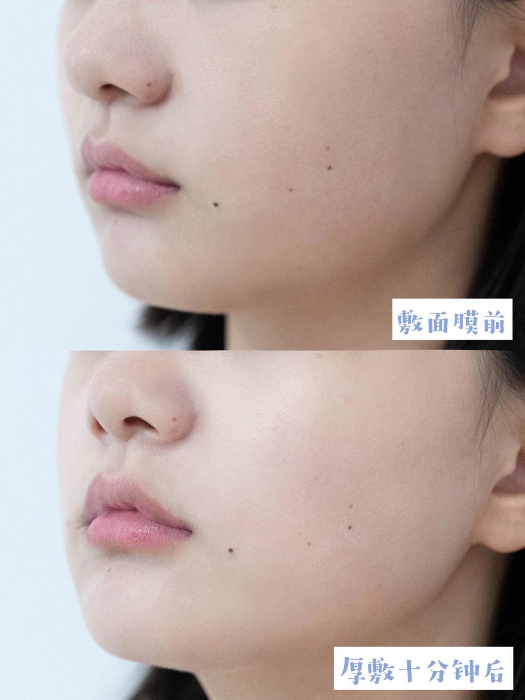 面容焦虑如何安慰,容貌焦虑