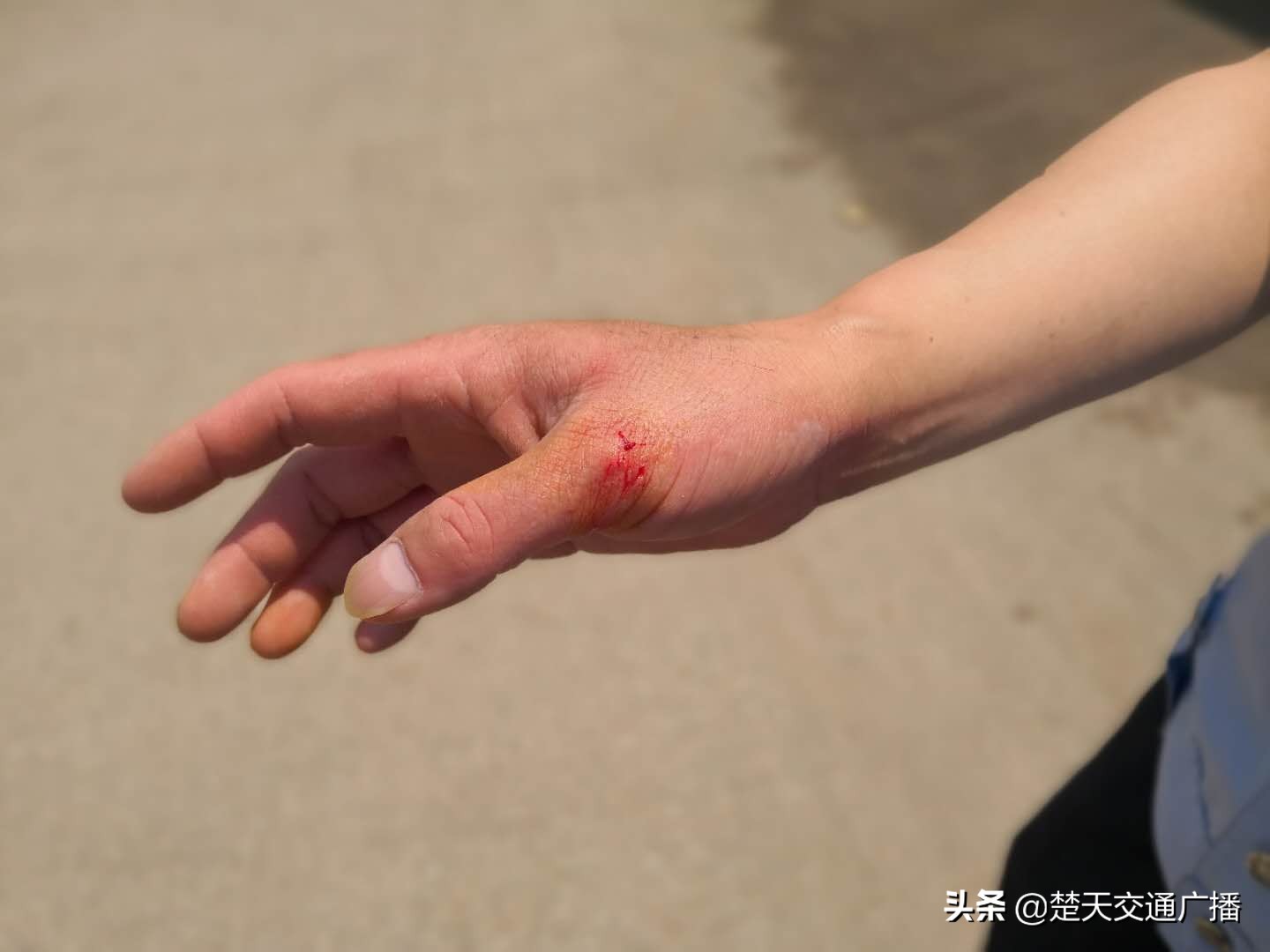 民警执法被咬怎么处理,抗拒交警执法被制服