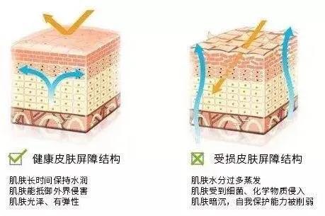 想要祛斑，先了解斑！有些斑连医美都治不好，你知道吗？