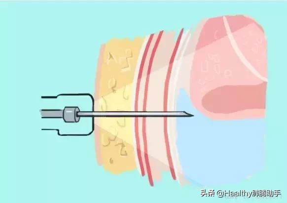 喘不过气的漫画,喘不上气的漫画