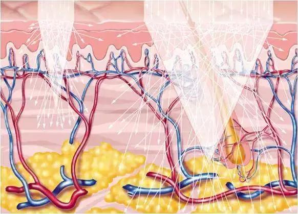 激光美容几月做比较好,激光美容有哪几种类型