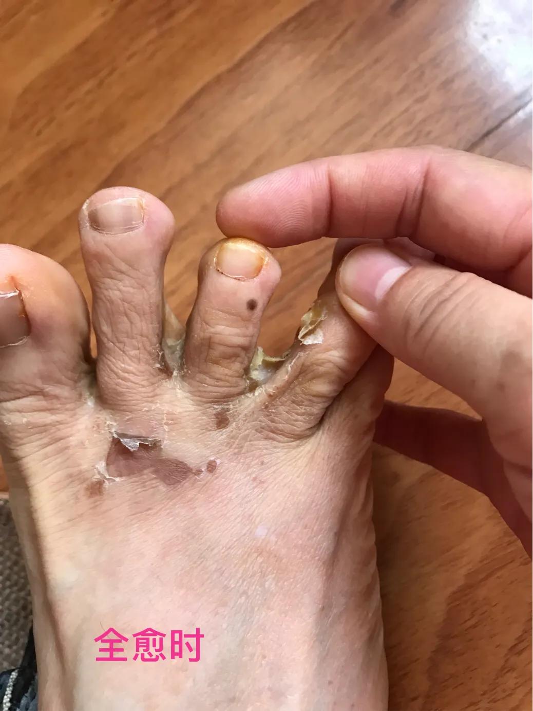 自己用中药熬的面膜靠谱吗,自己用中药做的面膜好吗