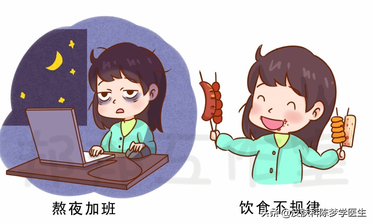 脸上青春痘用什么药膏,青春痘祛痘印推荐药物有哪些