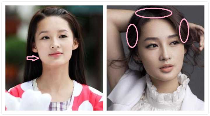 咬肌型发腮怎么改善,大脸方脸女生如何快速改变脸型