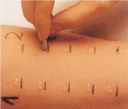 孩子季节性过敏性鼻炎温馨提醒,春季儿童过敏性鼻炎科普