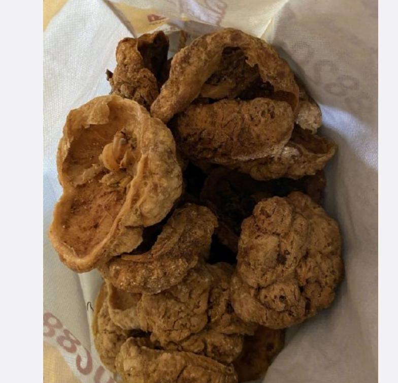 315人体胎盘,健康胎盘真的可以吃吗