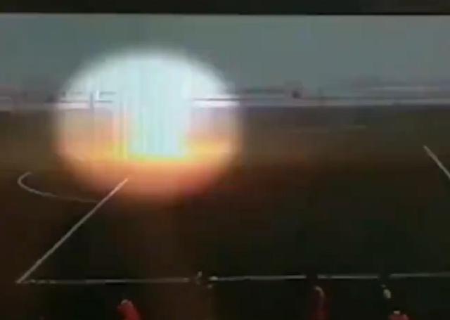 受伤最严重的足球运动员,足球运动员受伤瞬间