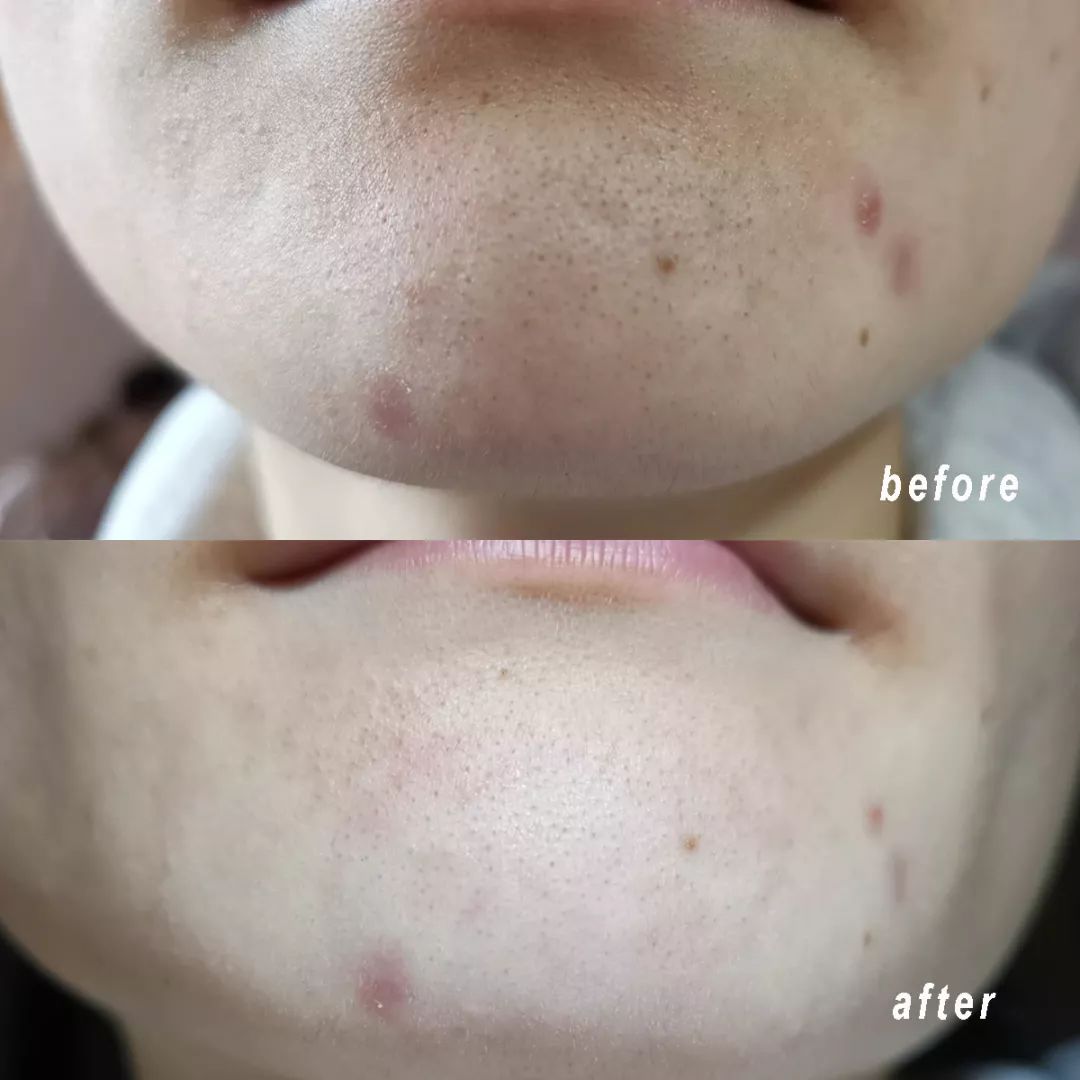 清洁面膜测评,清洁面膜测评打假