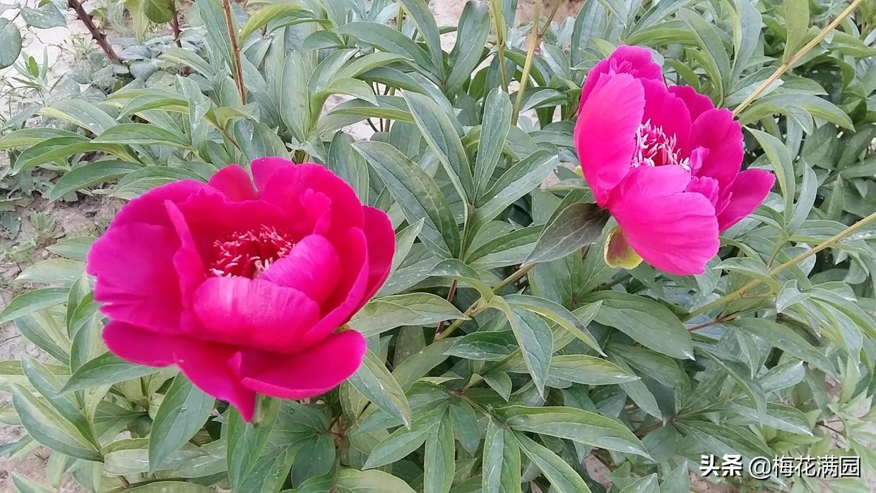 脱发的故事：那位大夫说得可真准啊