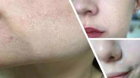 韩斯清把pony给迷住了！李佳琦+小P老师也上瘾，不愧是鼻祖级BB霜