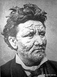 为中国“驱逐病魔”美国人马海德：娶了“延安第一美女”你知道吗