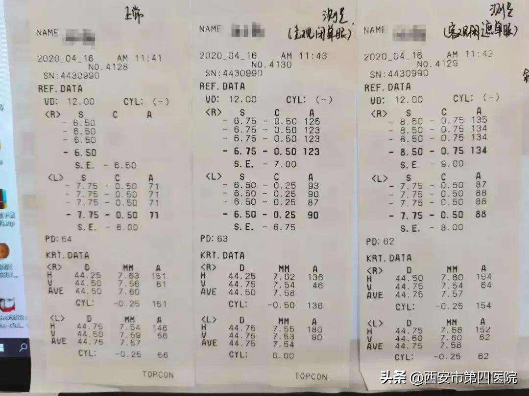 近视眼镜近处清楚远处模糊,近视看清楚近处较模糊