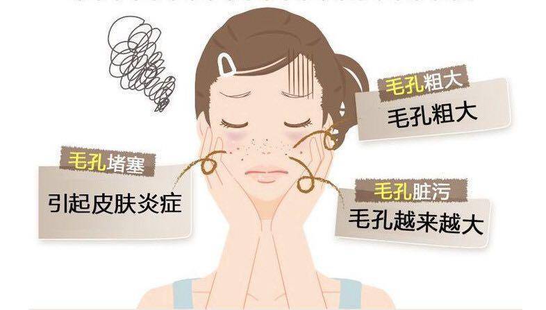 去黑头粉刺最好的建议,真正有效祛黑头粉刺