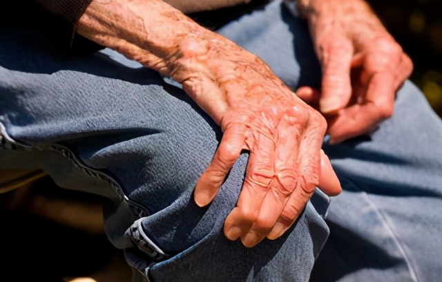 65％脑梗患者会出现痉挛现象，4大方法降低肌张力，缓解痉挛