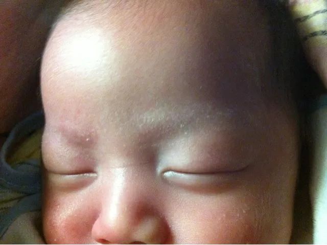 单眼皮宝宝遭亲爸嫌弃，2个月后完美逆袭，真相和你想的不一样